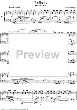 Prelude, Op. 28, No. 6 in B Minor