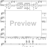 I Think I'm Going Bald